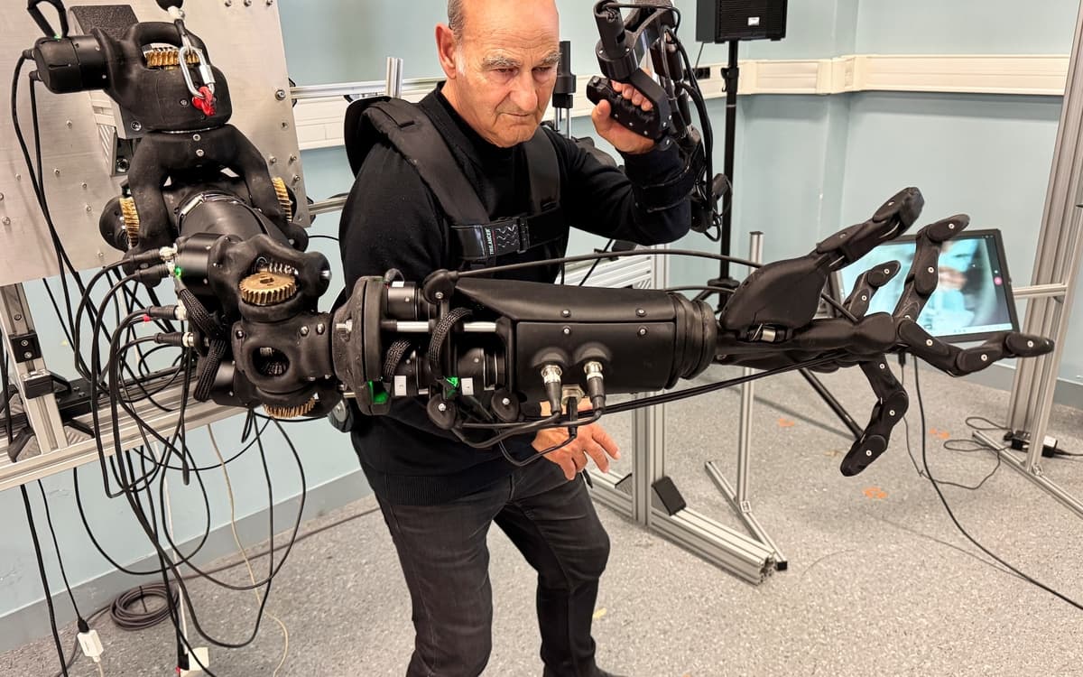 Stelarc – Hypertrophic Ambidextrous Hand and Arm